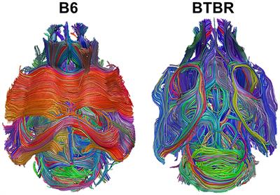 Differential Effects of Brain Disorders on Structural and Functional Connectivity